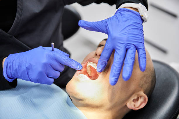Best Chipped Tooth Repair Near Me  in St Petersburg, FL